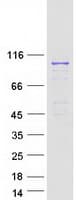 Human RASEF Protein (Recombinant Myc-DDK (Flag))