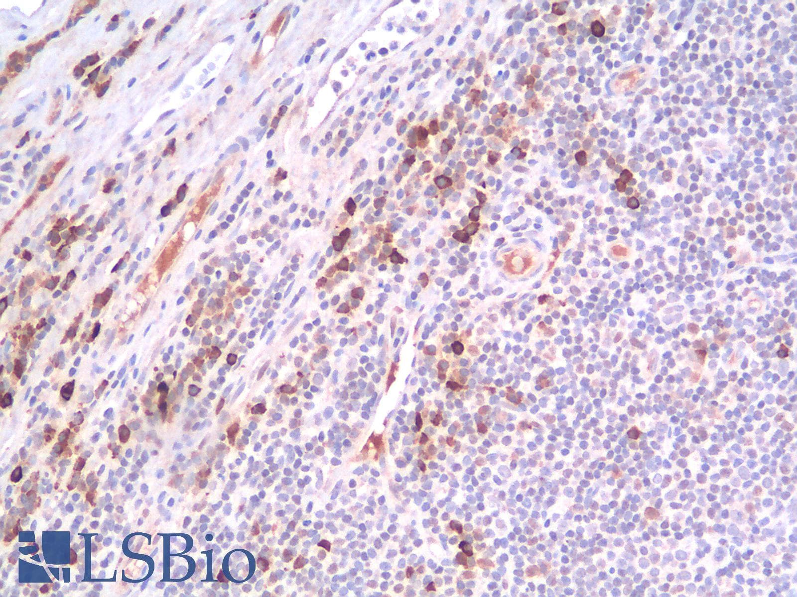 PathPlus™ Recombinant Monoclonal Mouse anti-Human CD44 Antibody (clone rCD44v9/1459, IHC)