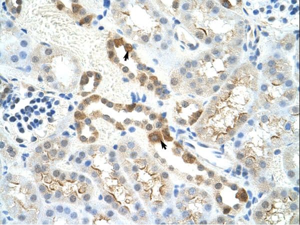 Polyclonal Rabbit anti-Mouse MYBBP1A Antibody (aa1201-1250, IHC, WB)