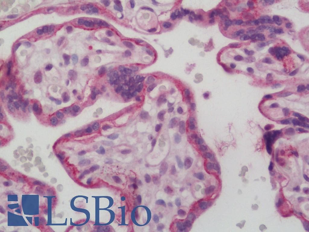 IHC-plus™ EGFR Antibody (aa661-710)