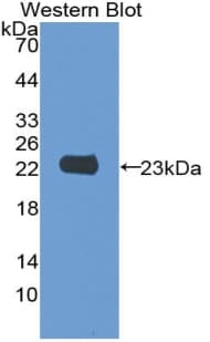 Zyxin Antibody (aa384-572, Biotin)