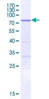 Human CLNK Protein (Recombinant GST)