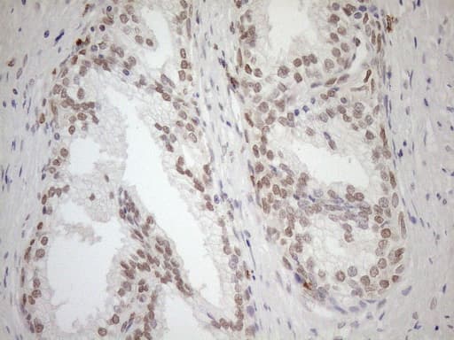 MGMT Antibody (clone OTI2E2)