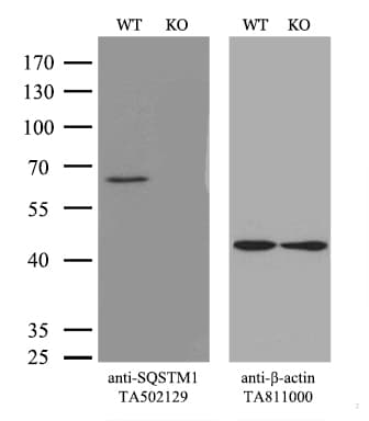 Monoclonal Mouse anti-Human SQSTM1 Antibody (clone UMAB12, Carrier-free, IHC, IF, WB)