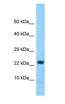 HINT2 Antibody (aa91-140)