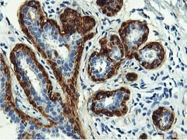 Monoclonal Mouse anti-Human TAGLN / Transgelin / SM22 Antibody (clone 8C8, Carrier-free, IHC, IF, WB)