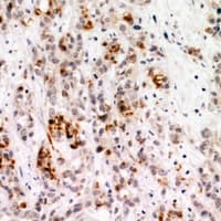 PHF9 / FANCL Antibody