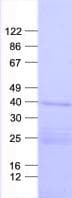 Human CHST6 Protein (Recombinant His, N-Terminal)