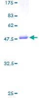 Human GUK1 / Guanylate Kinase 1 Protein (Recombinant GST)
