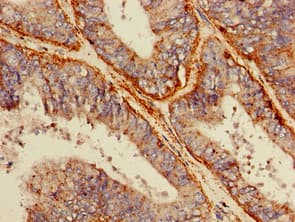 LIMPII / SCARB2 Antibody