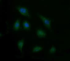 CD105 Antibody (clone OTI6G8)