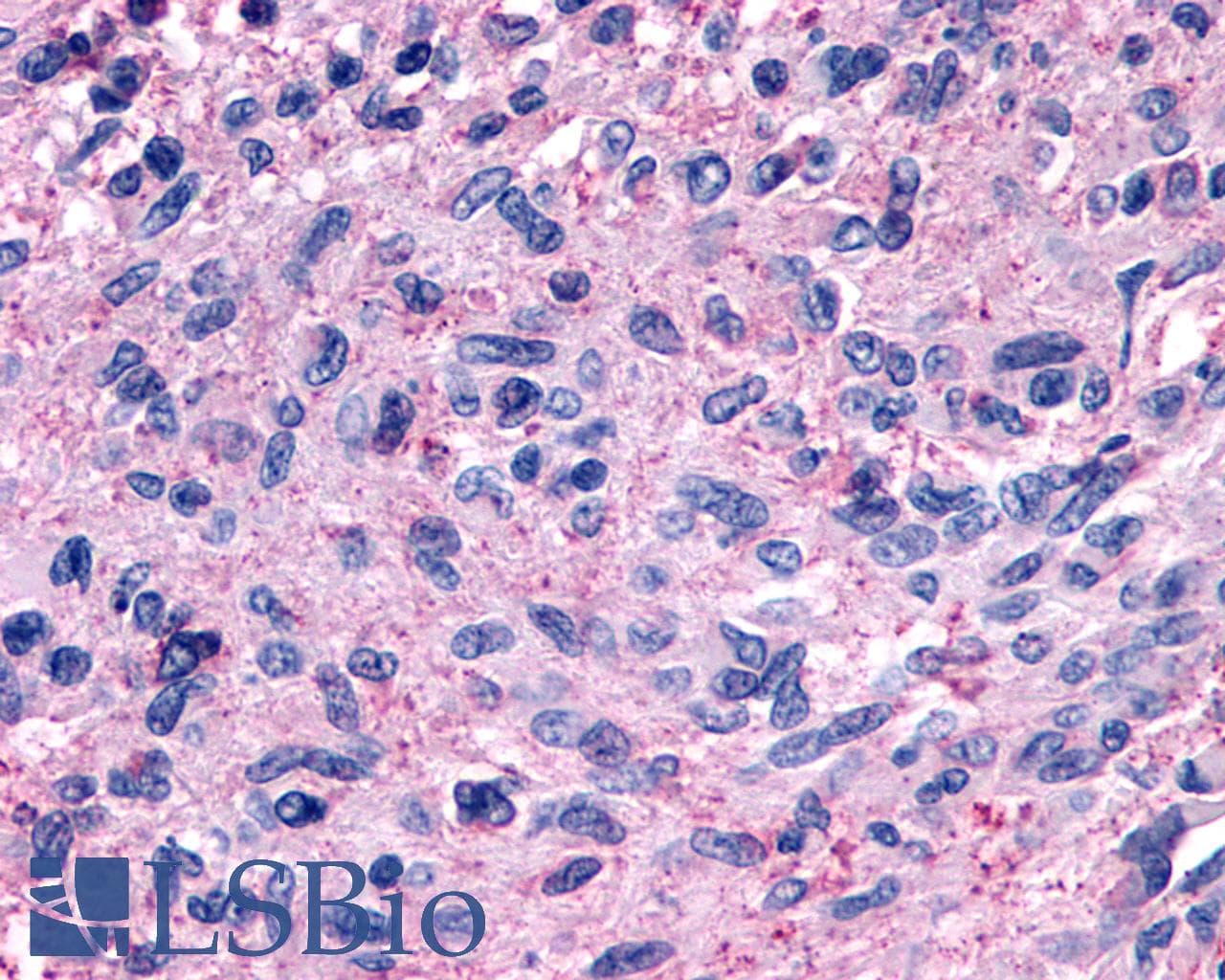 PathPlus™ GPR139 Antibody (Cytoplasmic Domain)