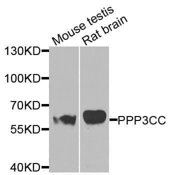 PPP3CC / CALNA3 Antibody