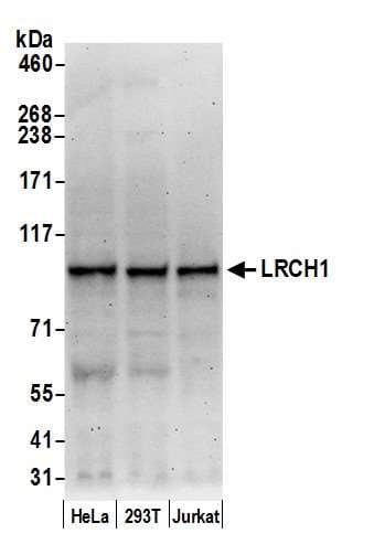 LRCH1 Antibody (aa325-375)