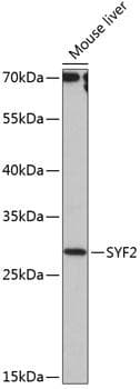Polyclonal Rabbit anti-Human SYF2 / p29 Antibody (WB)