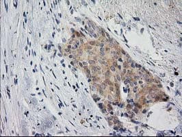 Monoclonal Mouse anti-Human EIF4E2 / IF4e Antibody (clone OTI1C1, IHC, WB)