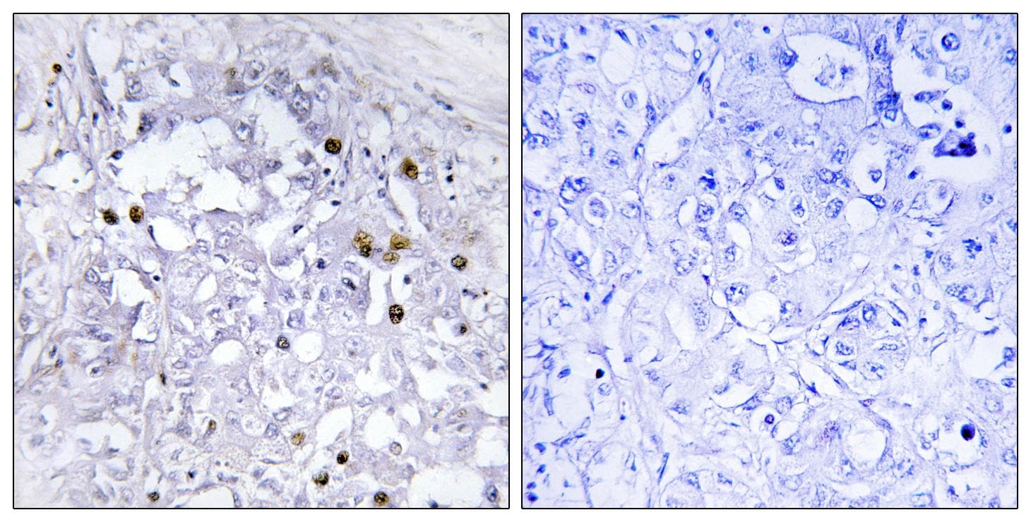 HNF4A / HNF4 Antibody (phospho-Ser313)