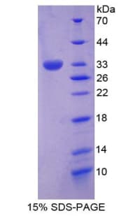 Human PTPRH / SAP-1 Protein (Recombinant His-T7)