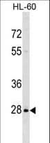 Polyclonal Rabbit anti-Human PPIL6 Antibody (aa30-58, WB)