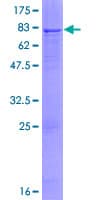Human SGSH Protein (Recombinant GST)