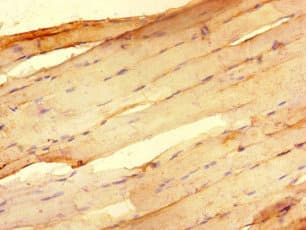 Polyclonal Rabbit anti-Human RNF4 Antibody (IHC, IF)