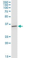 SDR9C1 / BDH1 Antibody (clone 4B3)