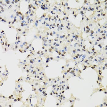 KDM4A / JHDM3A / JMJD2A Antibody