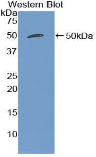 EMA / MUC1 Antibody (aa474-630)