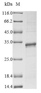 Fruit fly RPL10 / Ribosomal Protein L10 (Recombinant 6His, N-terminus)