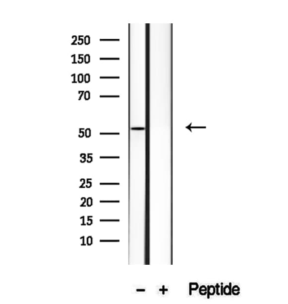 HERPUD1 / HERP Antibody