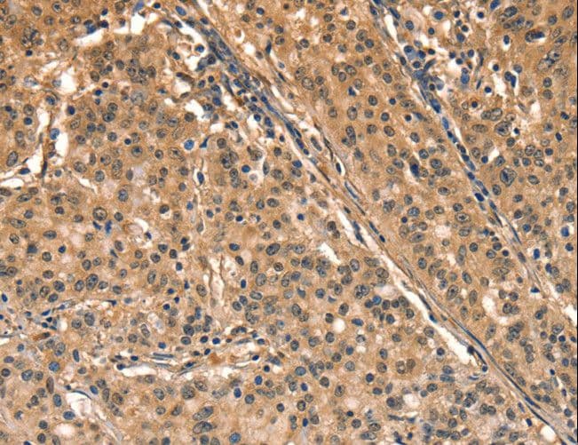 AIMP1 / EMAP II Antibody