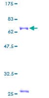 Human NDUFA10 Protein (Recombinant GST)