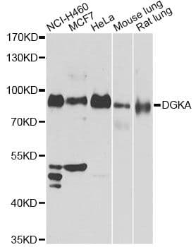 DGKA Antibody