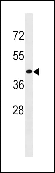 CD200R1L Antibody (aa63-92)