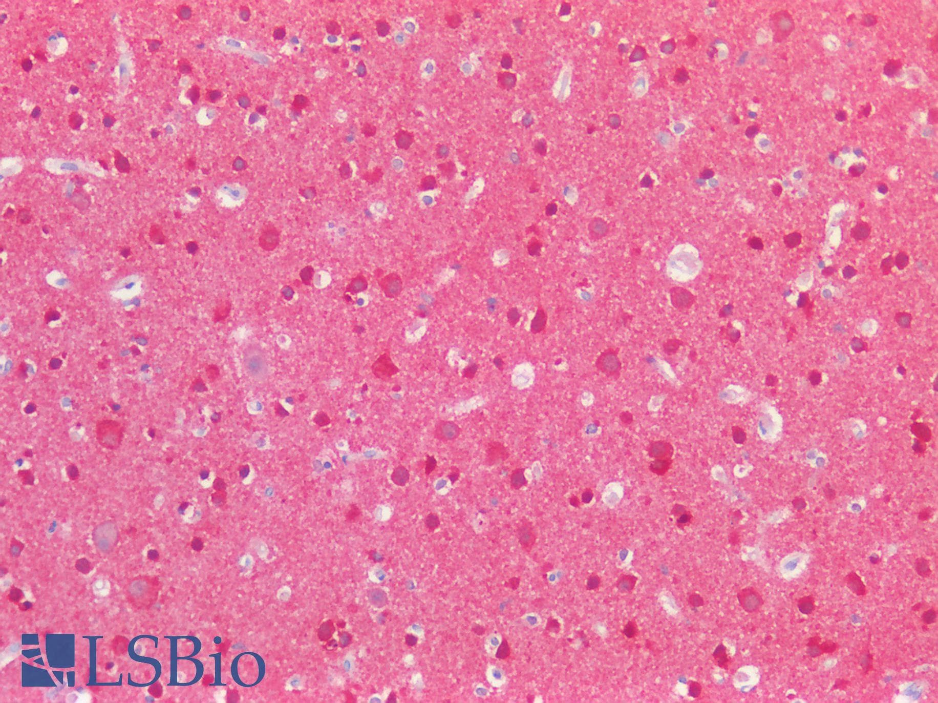 PathPlus™ MAPT / Tau Antibody (aa463-512)