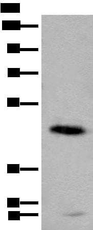 CADM2 Antibody