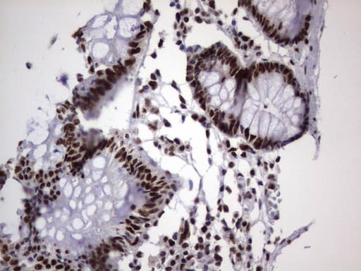 DDX56 Antibody (aa323-547, clone UMAB152)
