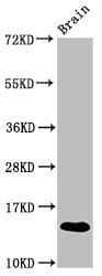 Polyclonal Rabbit anti-Mouse S100A9 / MRP14 Antibody (WB)