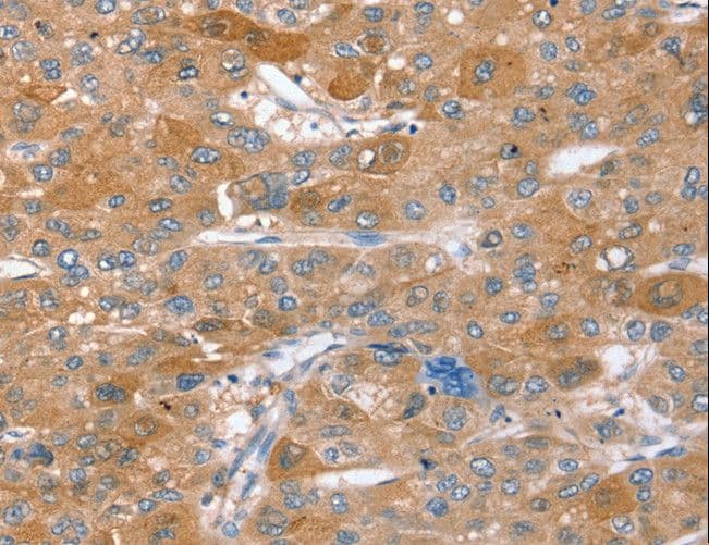 Polyclonal Rabbit anti-Human STX2 / Syntaxin 2 Antibody (IHC, WB)