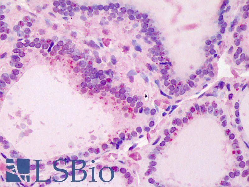 IHC-plus™ Polyclonal Goat anti-Human UBE2N / UBC13 Antibody (IHC, WB)