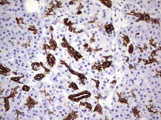 Monoclonal Mouse anti-Human KRT19 / CK19 / Cytokeratin 19 Antibody (clone OTI1F5, aa240-390, IHC, WB)