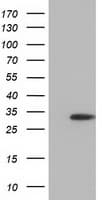 Monoclonal Mouse anti-Human SULT2A1 / Sulfotransferase 2A1 Antibody (clone OTI1D2, WB)