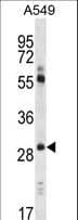 Polyclonal Rabbit anti-Human CLDN1 / Claudin 1 Antibody (aa40-82, IHC, WB)