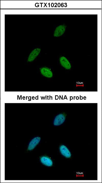NXF1 / TAP Antibody (aa449-619)