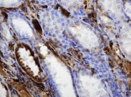 TP / Thymidine Phosphorylase Antibody (clone OTI1H7)
