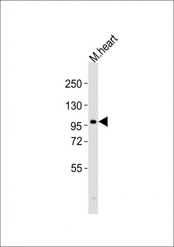 Polyclonal Rabbit anti-Human ATG9A Antibody (aa515-548, WB)