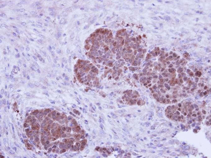 ZPR1 / ZNF259 Antibody (aa159-459)