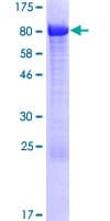 Human CMIP Protein (Recombinant GST)
