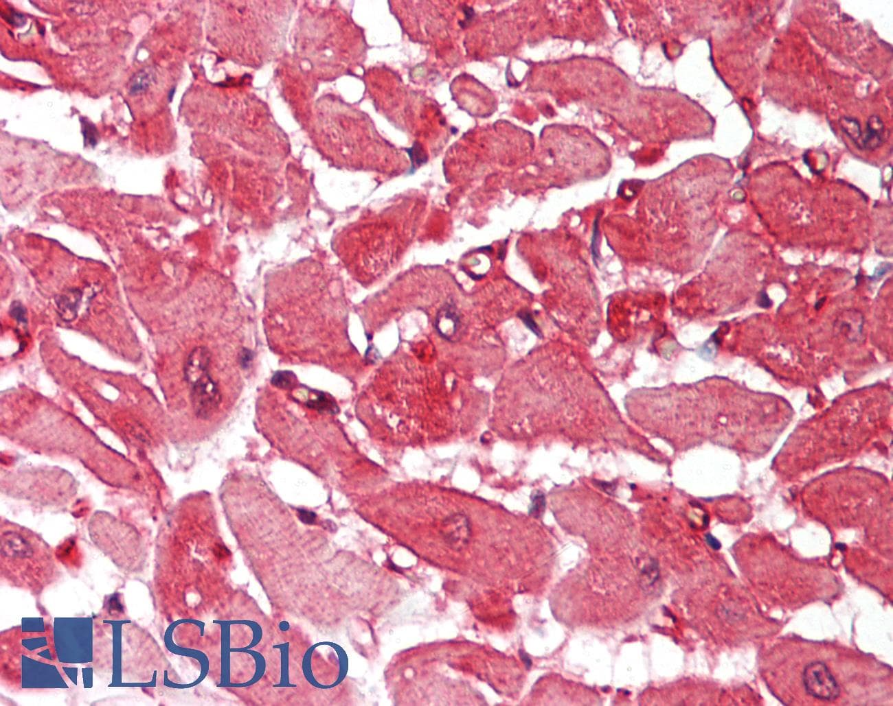 ACTN2 Antibody (N-Terminus)