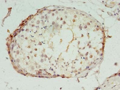 POLR2I Antibody
